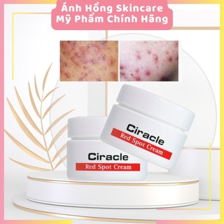 (Date 7.2025) Ciracle Red Spot Cream [Sạch mụn 100%-Hàng Auth] Kem Ciracle giảm mụn, xóa mờ vết thâm, trắng da hiệu quả