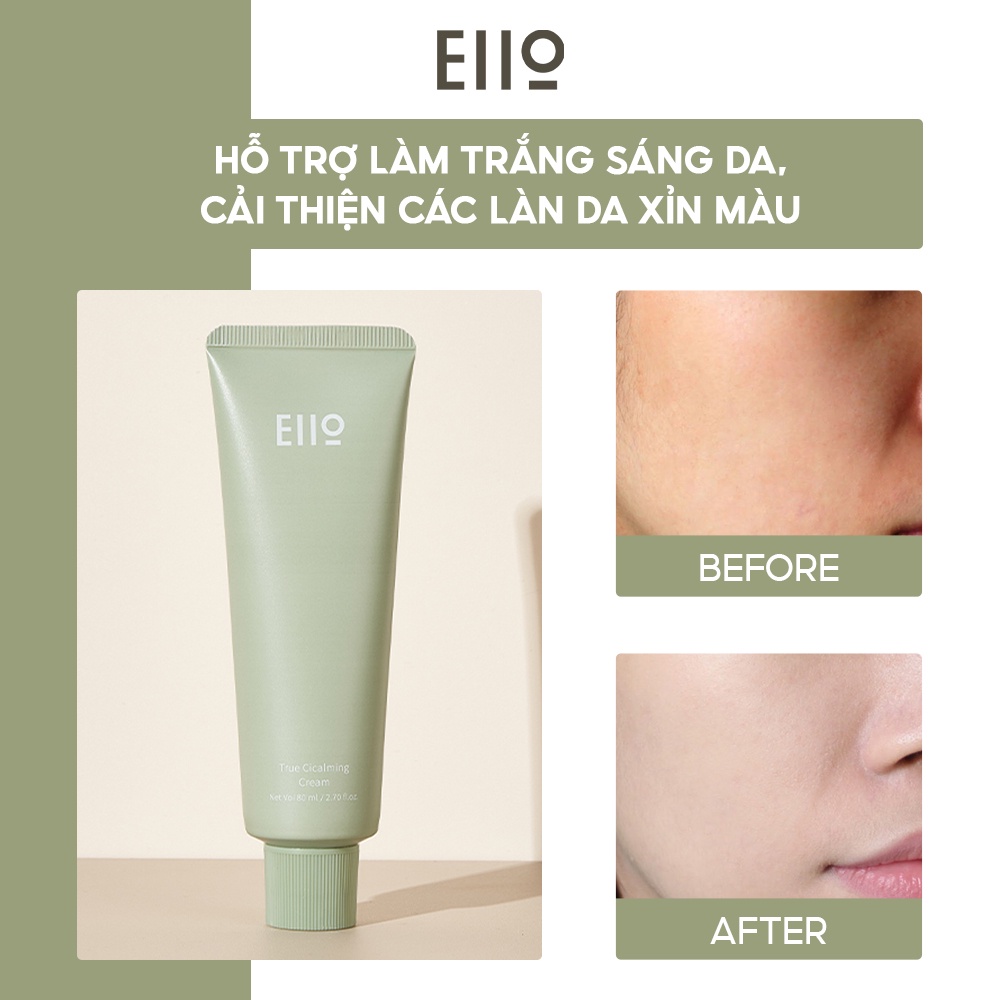 Kem dưỡng làm dịu da EIIO TRUE CICALMING CREAM 80ml