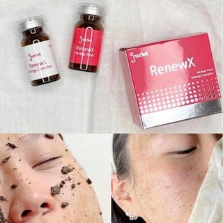 BỘ PEEL DA THẢO DƯỢC JURLET RENEWX HERBAL PEEL