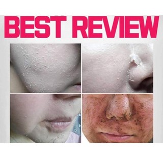 BỘ PEEL DA THẢO DƯỢC JURLET RENEWX HERBAL PEEL