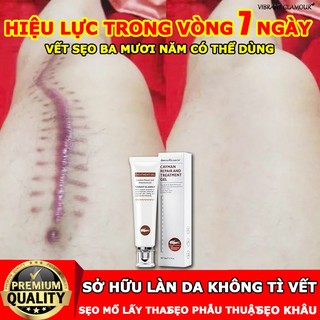 Sửa chữa tất cả các loại của vết sẹo,vết sẹo,kem xóa sẹo,Chống rạn da Chống,sẹo do bị thương,sẹo bỏng,sẹo phẫu thuật