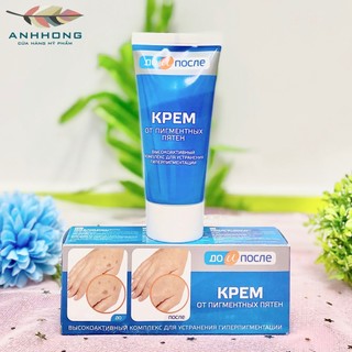Kem đồi mồi tay chân Kpem Nga - Kem xóa mờ đồi mồi đốm nâu tàn nhang chống lão hóa da tay chân hiệu quả