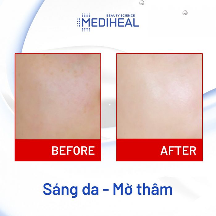 Kem Dưỡng Trắng Da Mờ Nám Trắng Da Mediheal Bright Melakill Cream 35ml Hàn Quốc