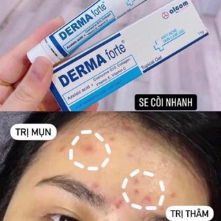 KEM MỤN DERMA FORTE 15G