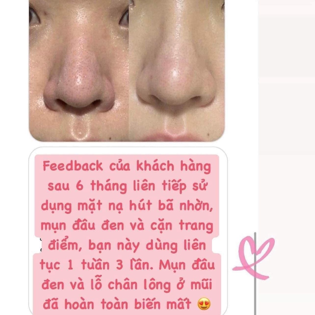 Mặt nạ 2in1 hút dầu, sợi bã nhờn, tẩy da chết cho da B:VID IN OUT  Hàn Quốc
