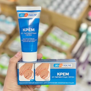 Kem Giảm Đồi Mồi Đốm nâu Da Tay Kpem Nga 50ml