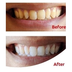 Kem Đánh Răng Làm Trắng Răng Cao Cấp Colgate Optic White 3,2oz pack 3 chính hãng Mỹ