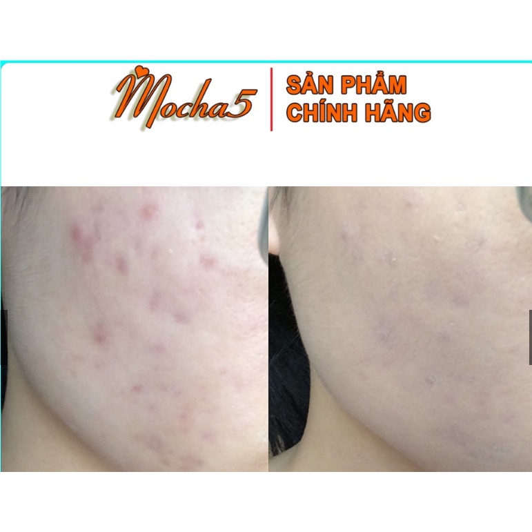 Kem Che Khuyết Điểm - Kem Che Khuyết Điểm The Seam Cover Perfection Tip Concealer SPF28 PA++ 6.5