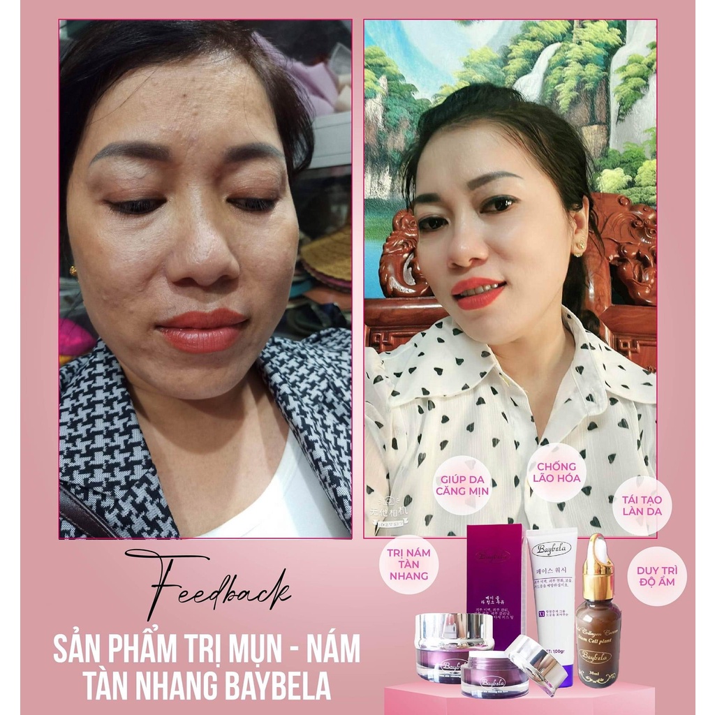 Kem đêm số 5 Baybela