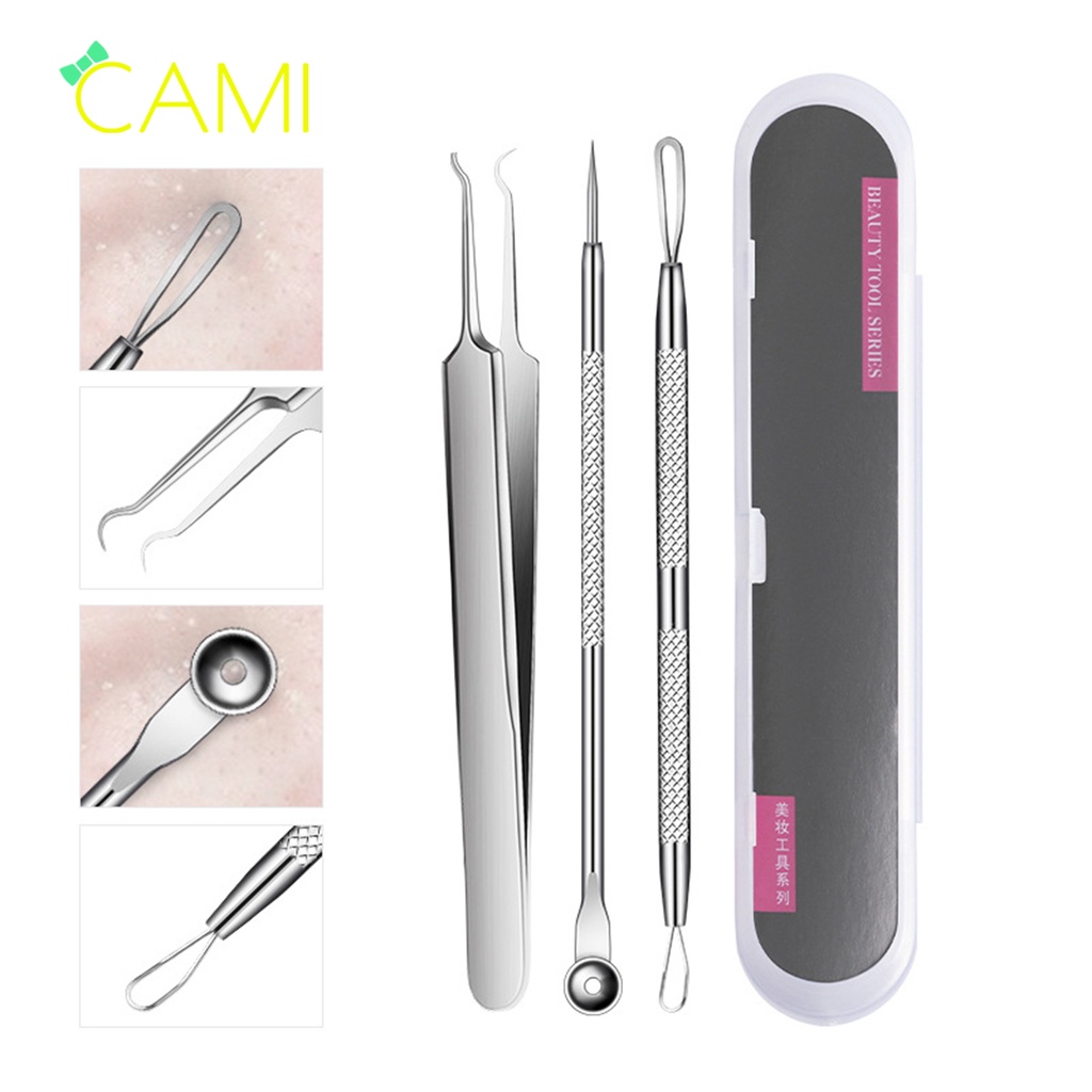 Bộ dụng cụ nặn mụn đa năng, 3 món đa dạng dễ dàng loại bỏ mụn cứng đầu, hộp nhựa chắc chắn dễ bảo quản - Cami - CMPK345
