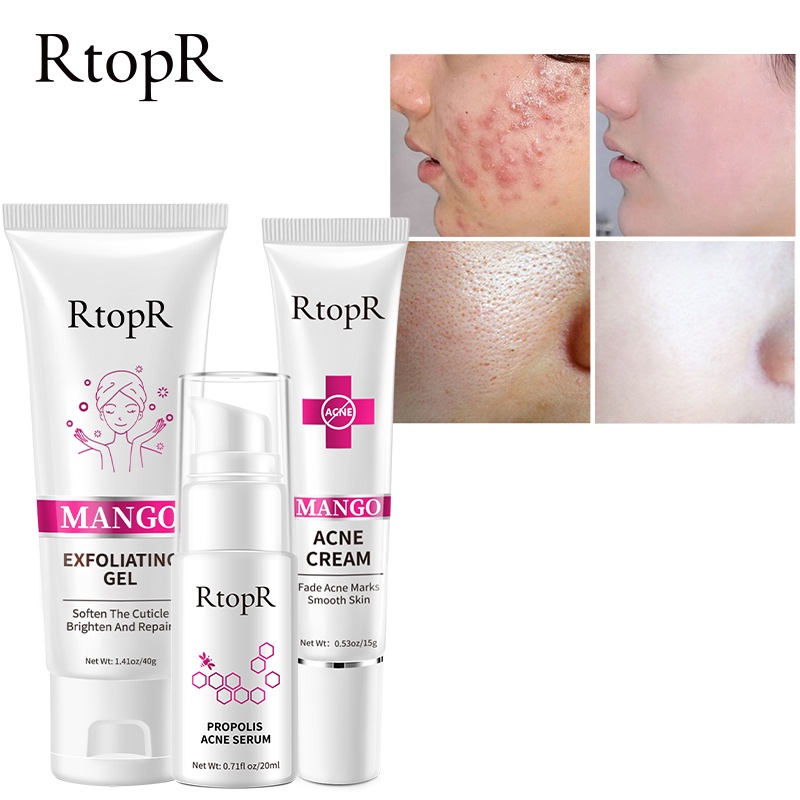 Bộ mỹ phẩm RTOPR gồm kem tẩy tế bào chết 40g+kem loại bỏ mụn từ xoài 15g+Serum làm sáng da loại bỏ mụn PROPOLIS 20ml