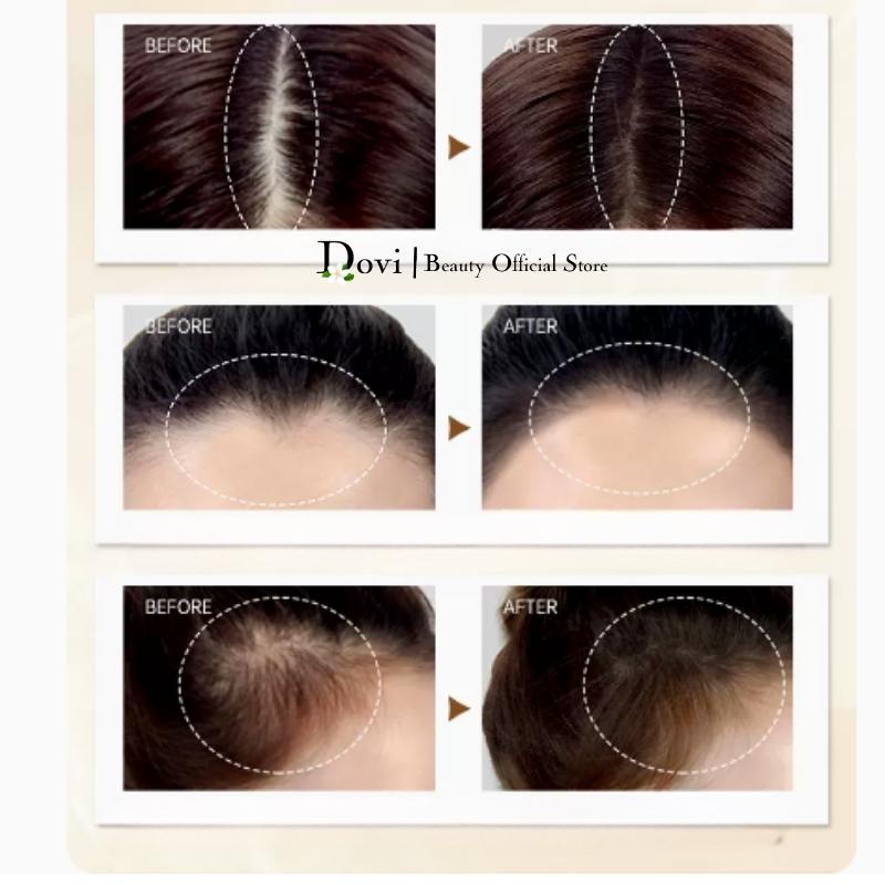 Phấn Che Khuyết Điểm Tóc MAYCHEER Che Phủ Tóc Hói Làm Hiệu Ứng Dày Chân Tóc