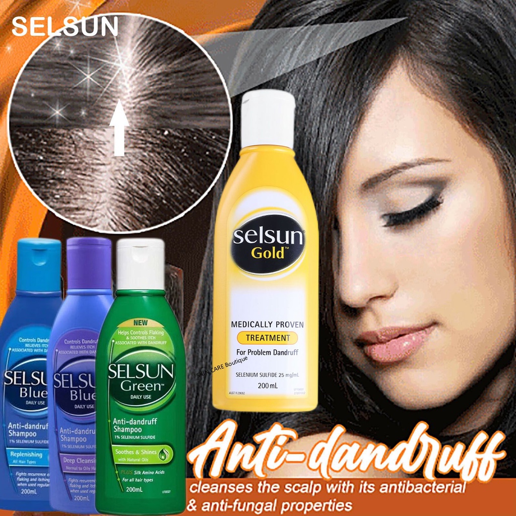 dầu gội trị gàu selsun 200ml Dầu Gội Chống Gàu Và Ngứa dầu gội cho da dầu anti-dandruff shampoo Dầu gội Chăm