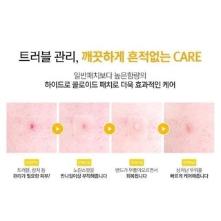 Miếng dán mụn Hatherine Spot Care Patch Kit (60 + 80 miếng)