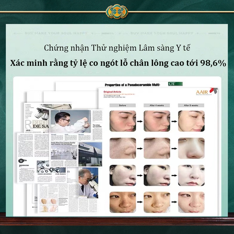 ⚡CHÍNH HÃNG⚡sữa rửa mặt trị mụn Sữa rửa mặt  kiểm soát dầu Sữa rửa mặt Centella Asiatica 300g làm giảm mụn Làm giảm đỏ da Dịu nhẹ và dưỡng ẩm Làm Sạch Sâu Kiểm Soát Dầu