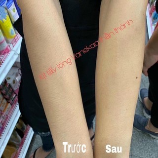 KEM TẨY LÔNG VANEKAA THÁI LAN