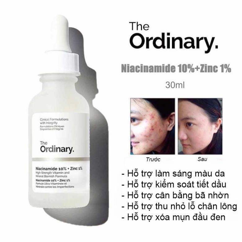 Serum The Ordinary Niacinamide 10% + Zinc 1% Giúp Cân Bằng Bã Nhờn Làm Sáng Da Thu Nhỏ Lỗ Chân Lông 30ml