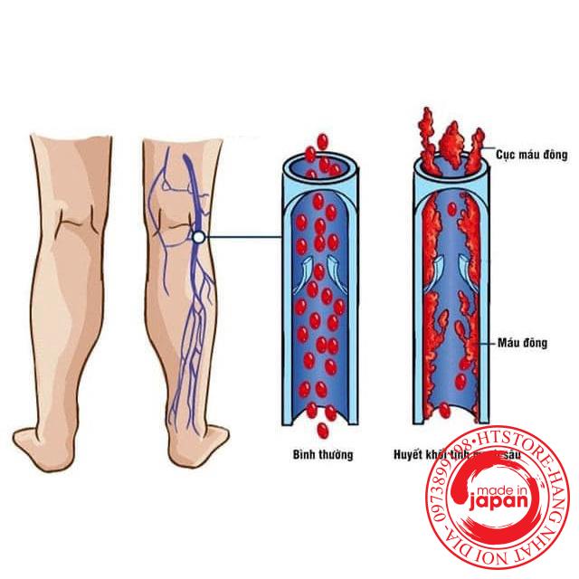 vn 11134201 7qukw lf2bri8aau16ab