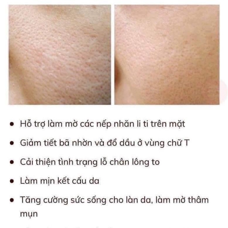 TINH CHẤT PAULA’S CHOICE NIACINAMINE TREATMENT 2ML