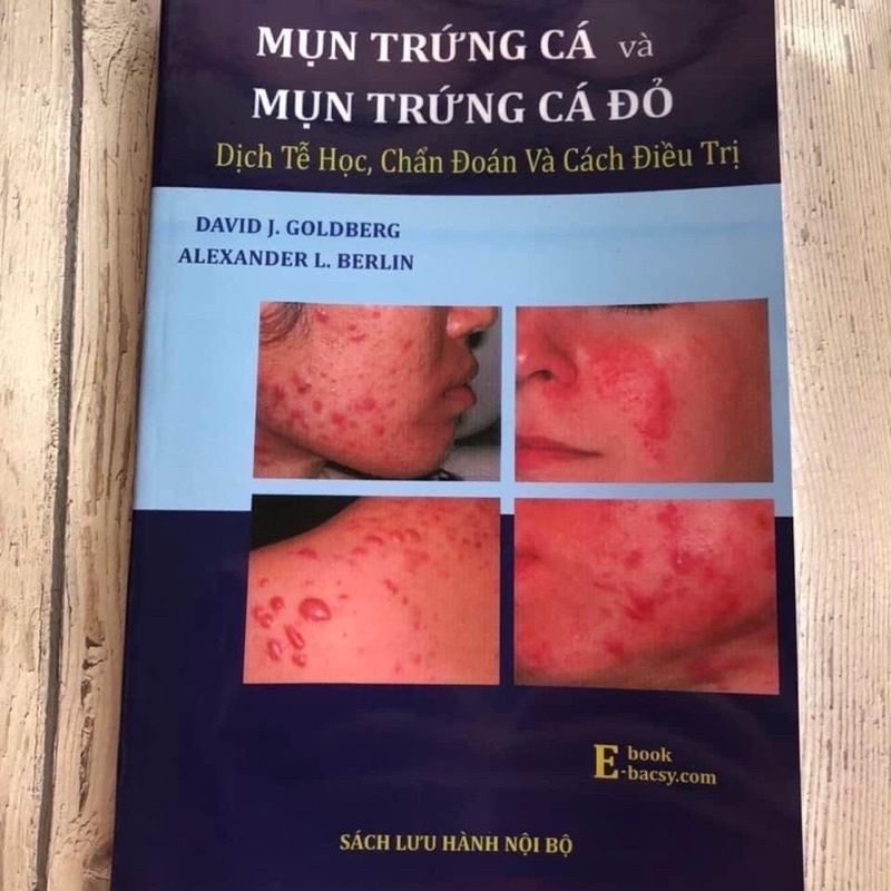 ✅ Mụn Trứng Cá