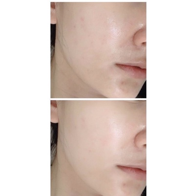 Kem dưỡng nâng tone Ildong Probiotic Radiance Tone up Cream 30ml