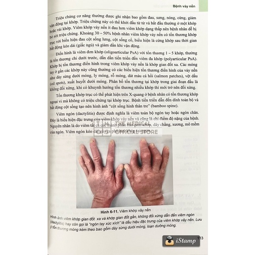 Sách - Da Liễu Cơ Bản và Bệnh Da Liễu Thường Gặp Tmos