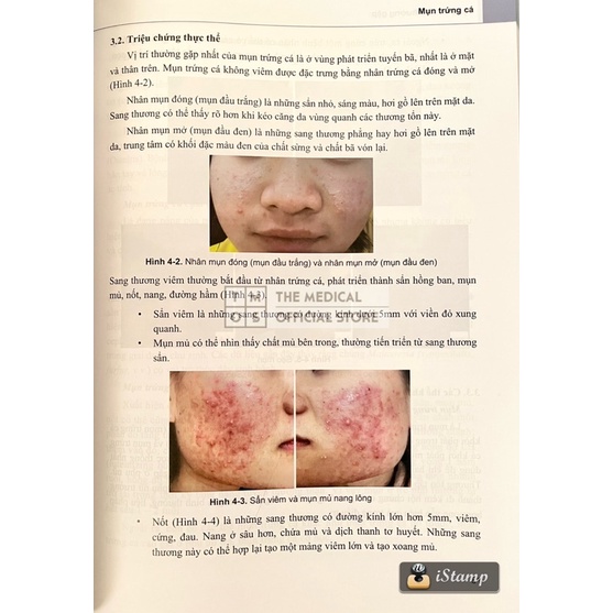 Sách - Da Liễu Cơ Bản và Bệnh Da Liễu Thường Gặp Tmos