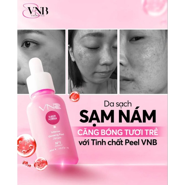 Serum peel mạnh vnb chính hãng