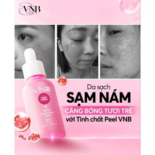 Serum peel mạnh vnb chính hãng 2027