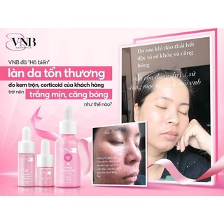 Serum peel 3days( date 2027)