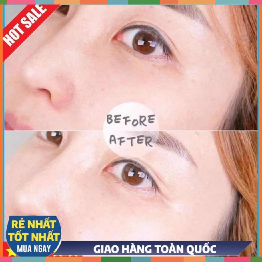 Kem mắt ESTEE LAUDER 5ml - Kem dưỡng mắt giảm thâm quầng nếp nhăn bọng mắt hiệuquả. Laroche -trami | BigBuy360 - bigbuy360.vn