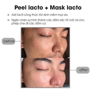 [FreeShip] Peel Lacto Onmacabim- trẻ hoá căng bóng 30 ml