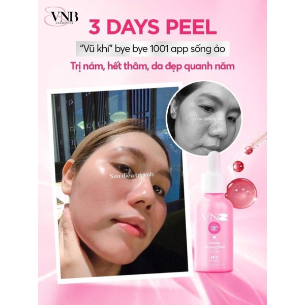 Serum peel 3days