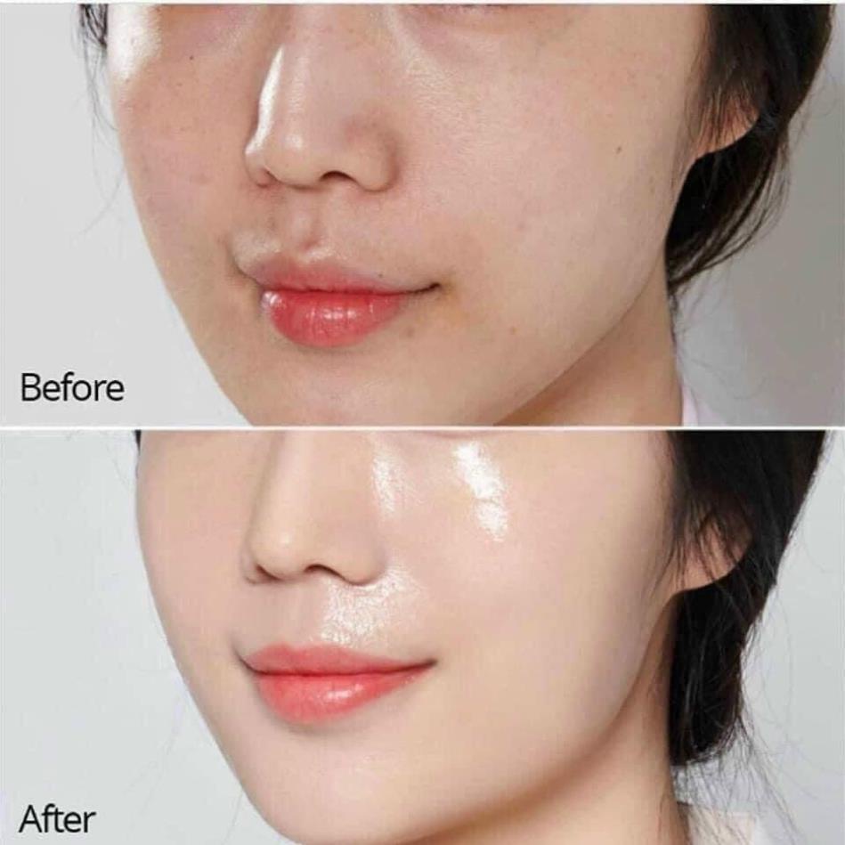 Kem Trẻ Hóa Phục Hồi Dưỡng Trắng Da Kem Dưỡng Retinol X5 30ml