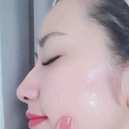 ( Tách Lẻ ) - Tế Bào Gốc - Ronas Hàn Quốc