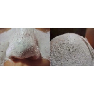 Gel lột mụn PEELING PACK .hot