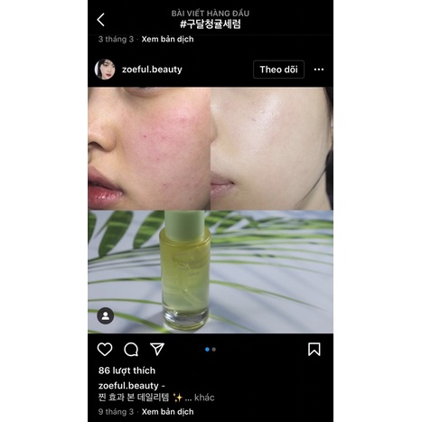 50ml  Tinh chất làm sáng da Green Tangerine Vita C Dark Spot Care Serum