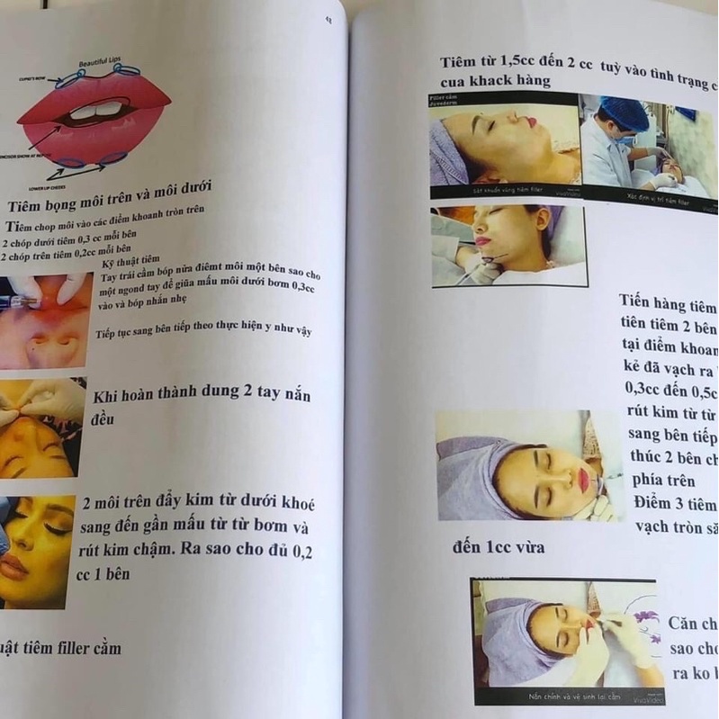✅ Giáo Trình - Tiêm Filler/chi tiết,cho người mới bắt đầu học