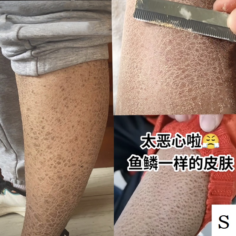 Kem Dưỡng Ẩm Làm Trắng Da Toàn Thân 100% Thành Phần Vảy Cá / Da Rắn