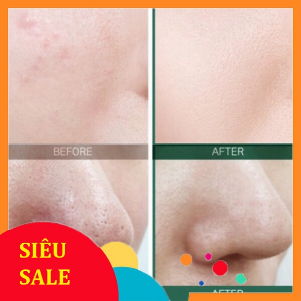 Nước hoa hồng AHA 30Days 150ml