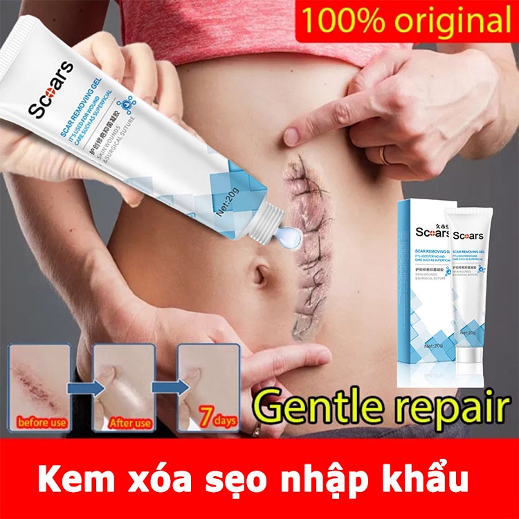 Hiệu quả nhanh chóng kem trị sẹo thâm/trị rạn da sau sinh/sẹo rỗ/trị sẹo lồi thuốc trị sẹo bỏng