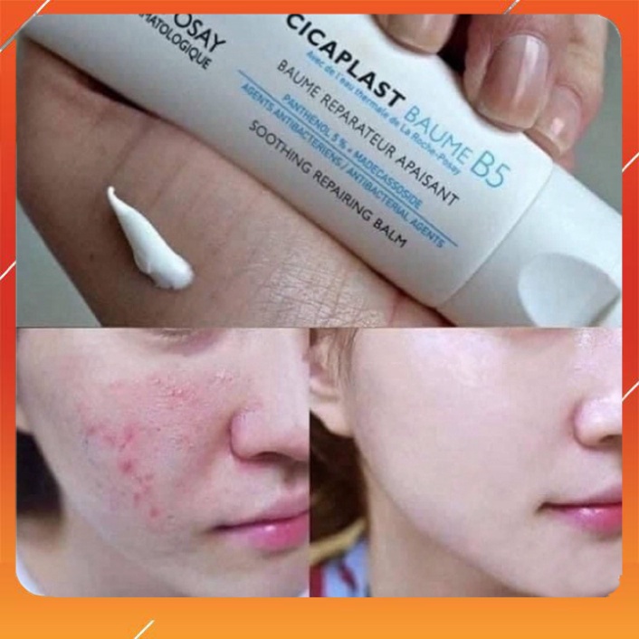 Kem Dưỡng Làm La Roche Posay Cicaplast Baume B5 40ml