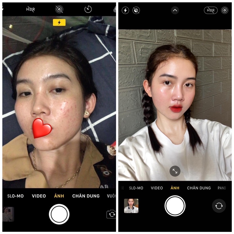 COMBO DƯỠNG DA SÁNG TỐI