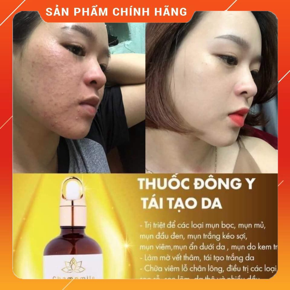 Tinh chất mụn ACNE SKIN SERUM Chamomileskill MẪU MỚI
