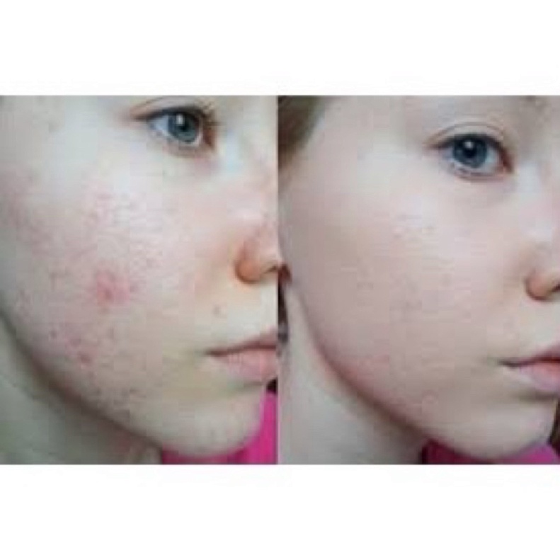Kem Dưỡng Làm Mờ Sẹo, Phục Hồi Và Tái Tạo Da Avene Cicalfate Repair Cream 100ml