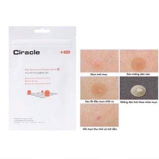 24 miếng] miếng dán mụn giúp làm dịu và hút dịch mủ ciracle red spot acne pimple patch