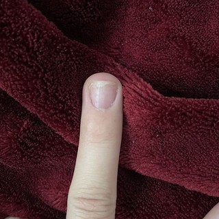 phục hồi móng nấm
