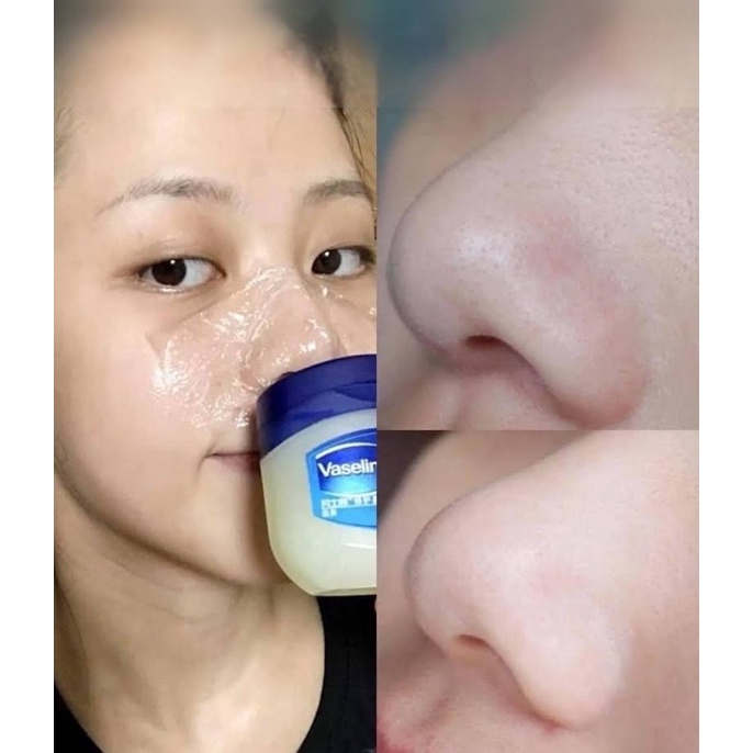 Sáp Dưỡng Ẩm Vaseline Đa Năng Pure Petroleum Jelly 49g-100ml-368g