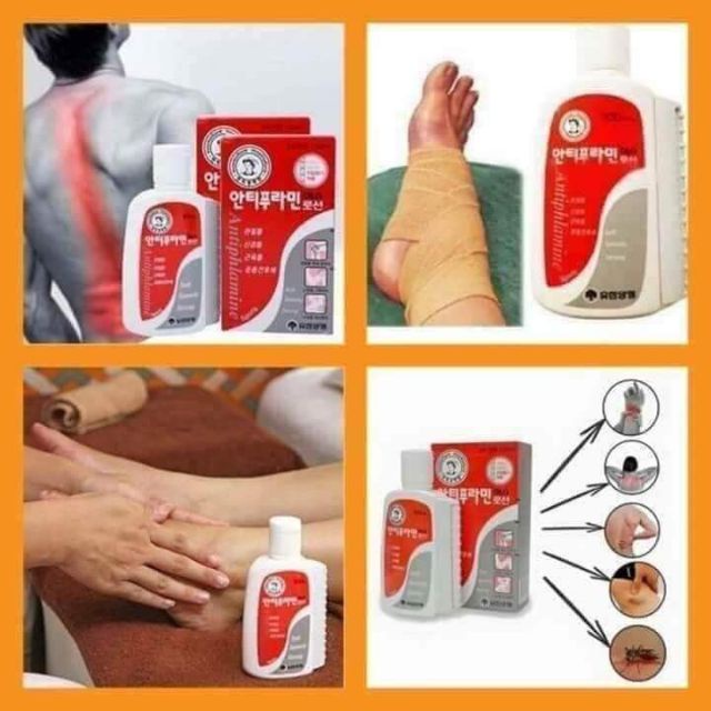 Dầu Nóng Xoa Bóp Hàn Quốc Antiphlamine 100ml giảm đau mỏi vai gáy, xương khớp, tê bì chân tay, vết bầm tím