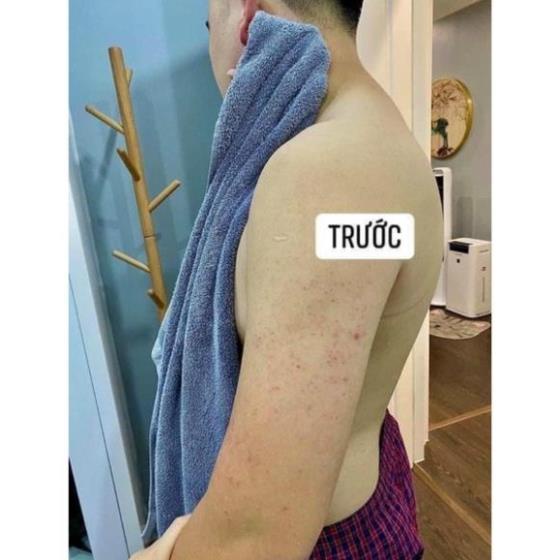 KELA LOTION vıêm LỖ châŋ LÔNG THÁI LAN 60ML ..